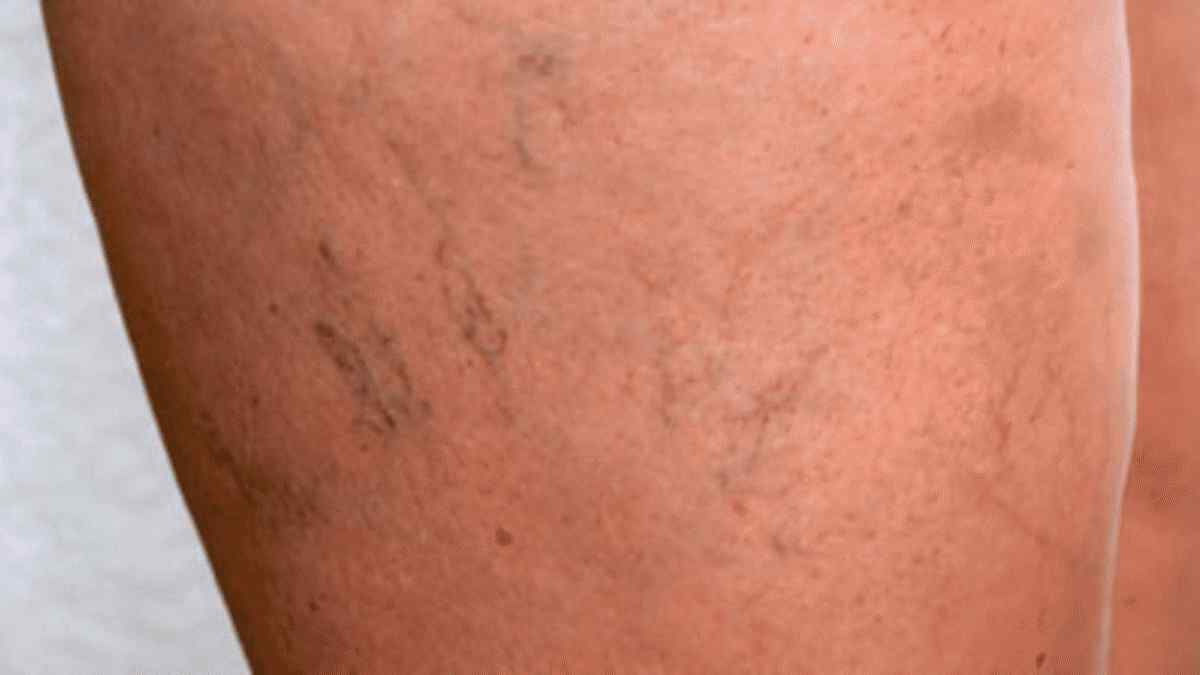 si le sang est rouge, pourquoi les veines paraissent-elles bleues ?